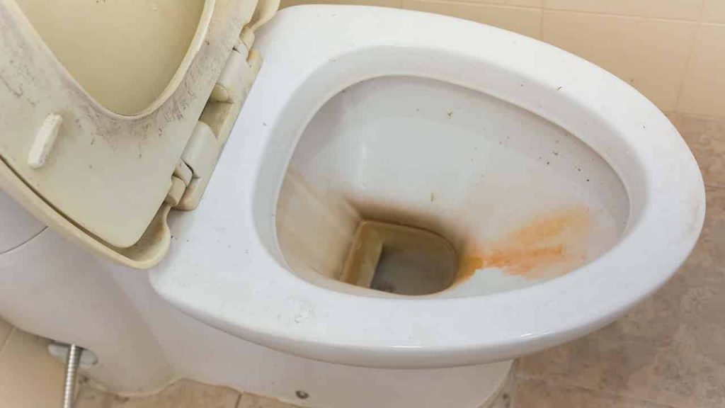 Cómo limpiar y blanquear el asiento amarillento del inodoro: 3 consejos infalibles – Mis Consejos Jardinería