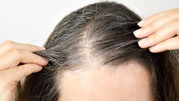 pelo blanco