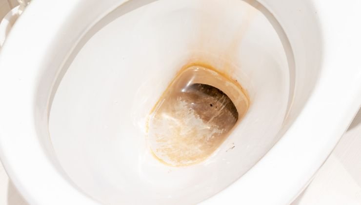macchie wc 