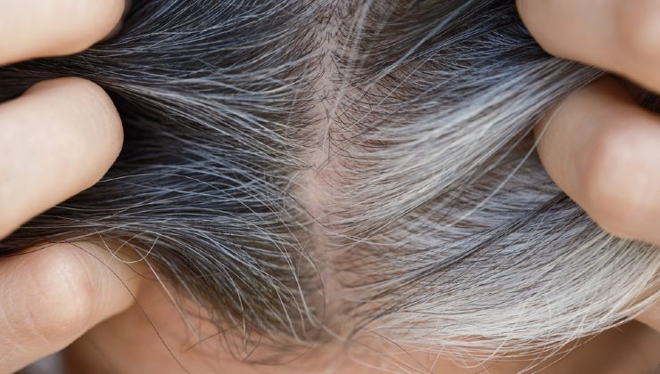 pelo blanco