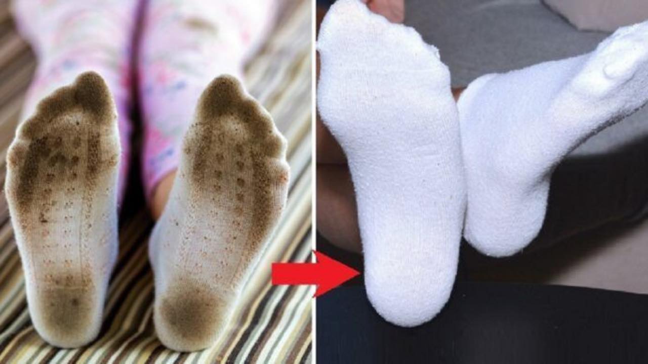 Calcetines sucios