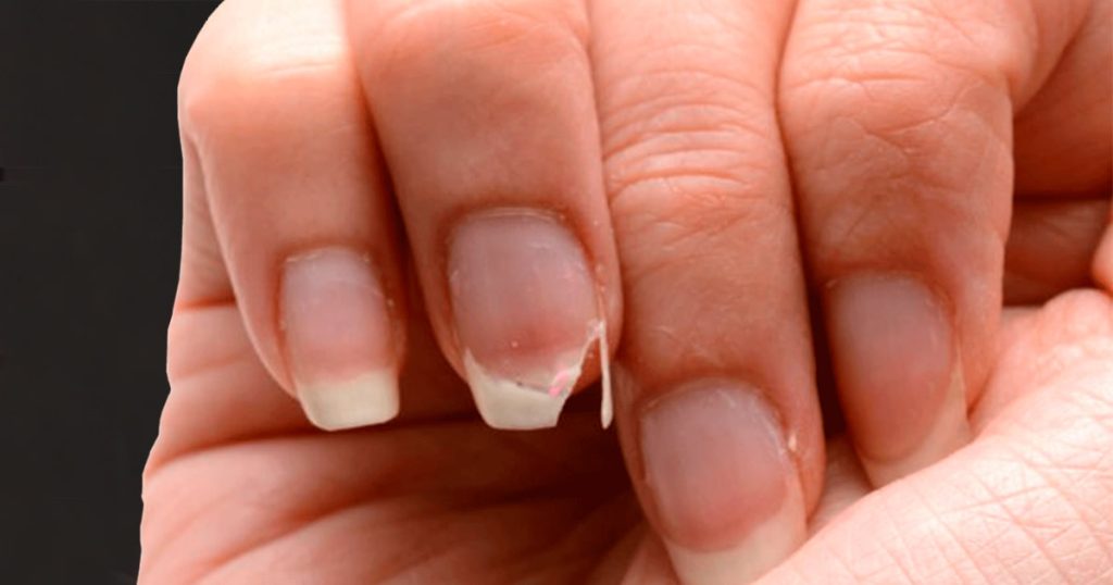 Cómo endurecer las uñas sin ajo: 3 recetas infalibles – Mis Consejos Jardinería