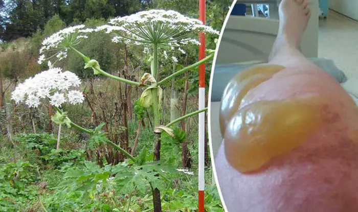 “Es muy venenosa”, máxima atención: esta planta te arruina